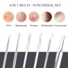 Picture of Boxoyx Pimple Popper Tool Kit - 6 Pcs Blackhead Remover Comedone Extractor Tool Kit with Metal Case for Quick and Easy Removal of Pimples, Blackheads, Zit Removing, Forehead, Facial and Nose(Silver)