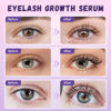 Picture of Eyelash Growth Serum, Premium Lash Serum Promotes Longer, Thicker, Fuller,Eyelash Serum Non Irritating (5ml)