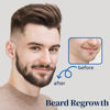 Picture of 5% Minoxidil Spray for Men and Women, Minoxidil for Women Hair Growth, Minoxidil for Men Hair Growth Spray 4PCS.