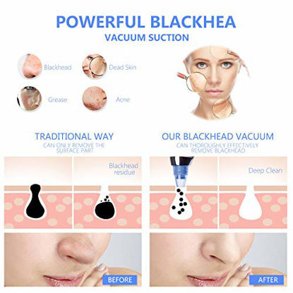 Picture of Blackhead Remover Vacuum Facial Acne Pore Cleaner Electronic Comedone,Blackhead and Pore Removal Extraction Kit Rechargeable Acne RemoverTools for Women Men Face Nose