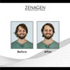 Picture of Zenagen Flexture Paste