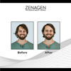 Picture of Zenagen Flexture Paste