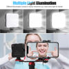Picture of Dental Photography Aid, Oral Cell Phone Camera Fill Light Brightness Led Video Light Studio Lighting Kit for Home, Clinic, Hospital