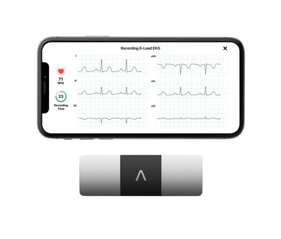 Picture of KardiaMobile 6-Lead Personal EKG Monitor - Six Views of The Heart - Detects AFib and Irregular Arrhythmias - Instant Results in 30 Seconds - Works with Most Smartphones - FSA/HSA Eligible